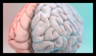 brain 300x169 1