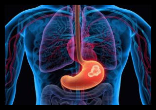 stomach 300x206 1